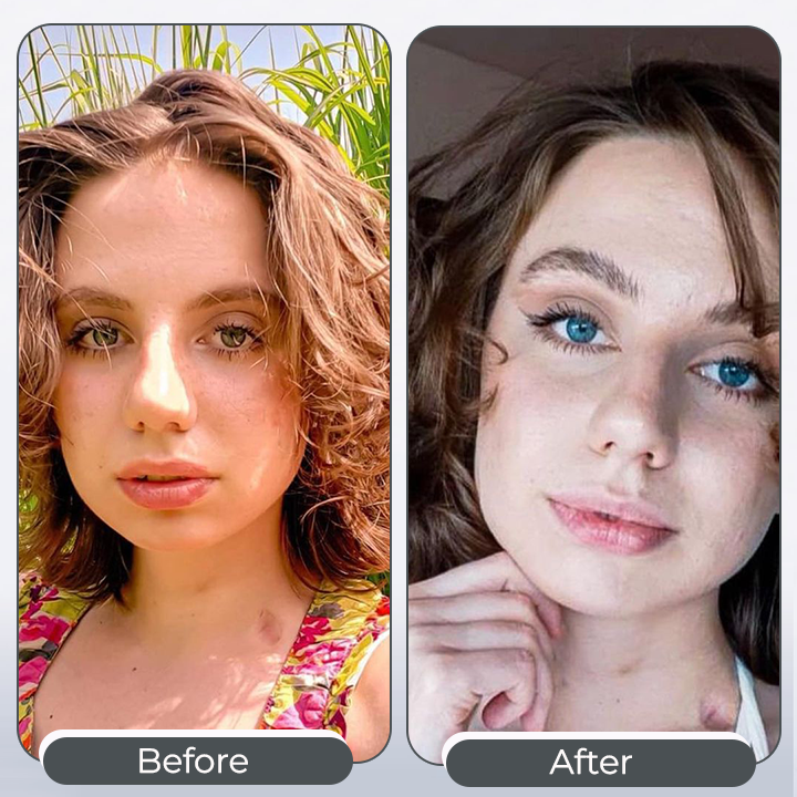 DarkFairy™ 𝑺𝒑𝒆𝒄𝒕𝒓𝒂𝑬𝒚𝒆 𝑪𝒐𝒍𝒐𝒓 𝑪𝒉𝒂𝒏𝒈𝒊𝒏𝒈 𝑫𝒓𝒐𝒑𝒔 𝑷𝒓𝒐 （👁️ Clinically Tested & Ophthalmologist Approved）